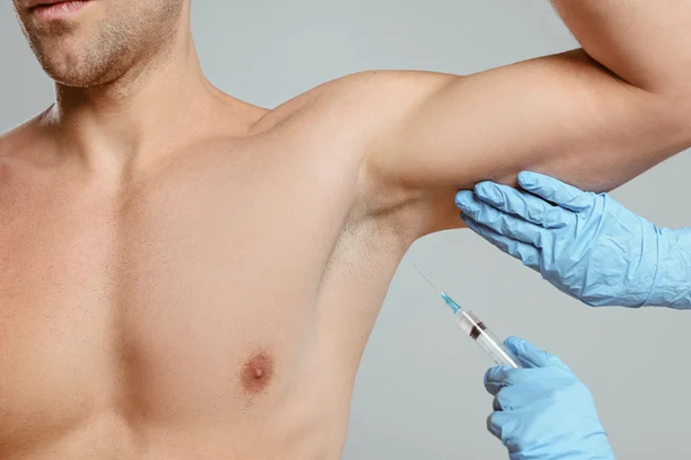 Hyperhidrosis Treatment Singapore