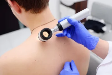 Skin Tag Removal