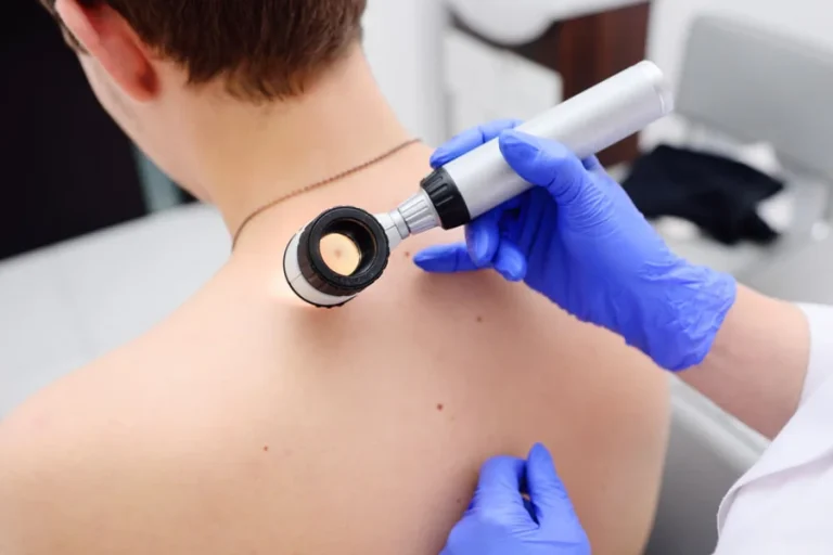 Skin Tag Removal