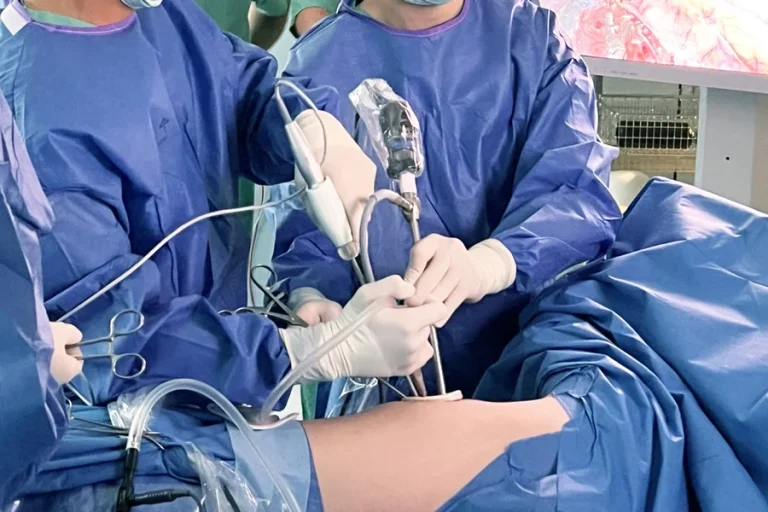 Cancer Surgery